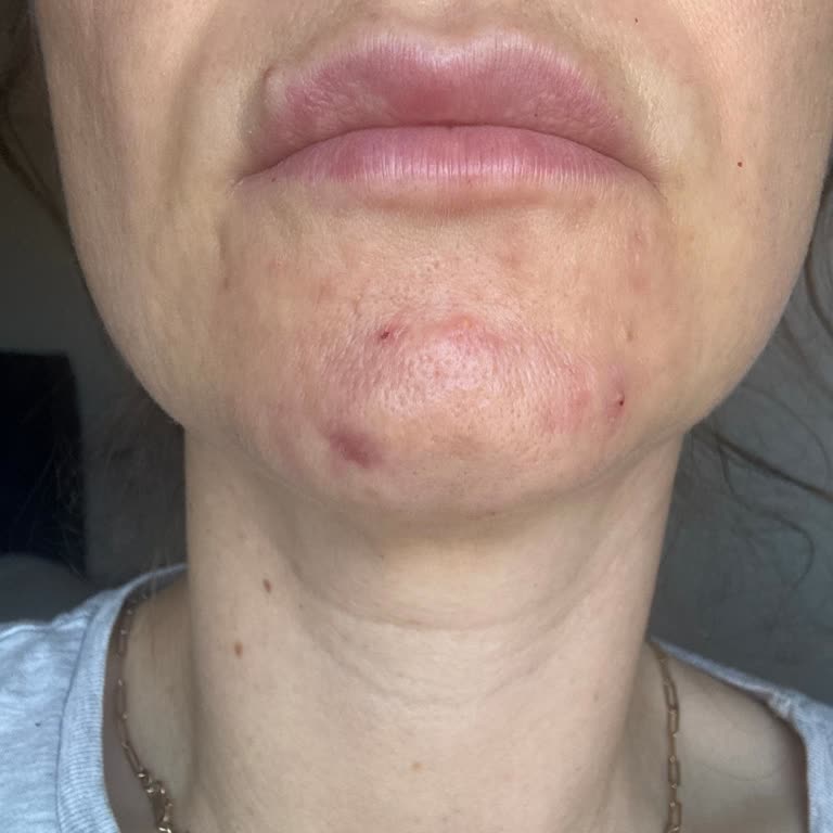 Uzm. Dr. Yahya Yiğit Hijyen Yok İşlemleri, Düzgün Yapmıyorlar