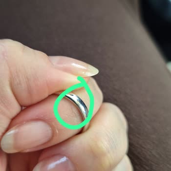 Kırık Alyansım Onarılmadı, Ağırlık Kaybı Yaşadım