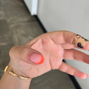 Dilara Kaya Beauty Ellerim Yara Oldu