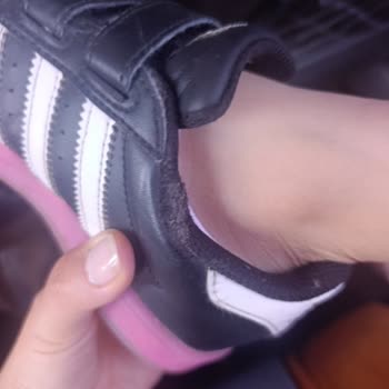 Adidas Superstar Çocuk Ayakkabısı Kısa Sürede Yıprandı, Garanti Reddedildi