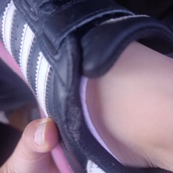 Adidas Superstar Çocuk Ayakkabısı Kısa Sürede Yıprandı, Garanti Reddedildi