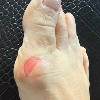 Deri Terlik İlk Kullanımda Ayağımı Yaraladı Müşteri Hizmetleri İlgisiz Kaldı