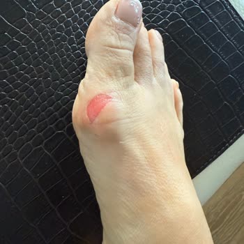 Deri Terlik İlk Kullanımda Ayağımı Yaraladı Müşteri Hizmetleri İlgisiz Kaldı