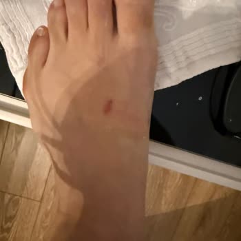 Deri Terlik İlk Kullanımda Ayağımı Yaraladı Müşteri Hizmetleri İlgisiz Kaldı