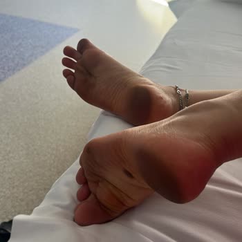 Elle Ayakkabı'dan Aldığım Sandaletin Kalitesizliği Ve Çözüm Talebim