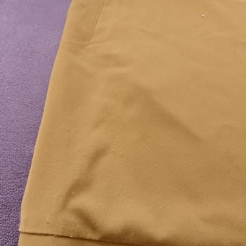 Üründe Tüylenme Ve Mağazanın İlgisizliği Mağdur Etti