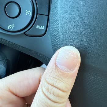 Hijyen Sorunu Ve Acı Dolu Manikür Pedikür Deneyimi