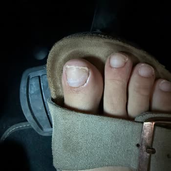 Hijyen Sorunu Ve Acı Dolu Manikür Pedikür Deneyimi