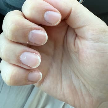 Hijyen Sorunu Ve Acı Dolu Manikür Pedikür Deneyimi