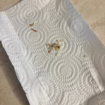 Efsane Baldo Pirinçte Kurt Şoku