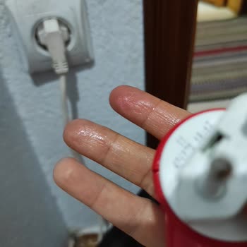 Sıvı Sinek Öldürücü Adaptöründe Aşırı Isınma Ve Sıvı Sızıntısı Sorunu