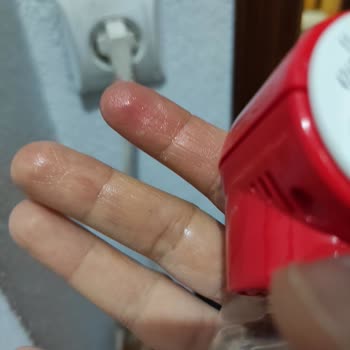 Sıvı Sinek Öldürücü Adaptöründe Aşırı Isınma Ve Sıvı Sızıntısı Sorunu