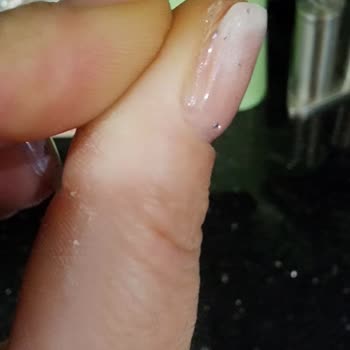 Hayal Kırıklığı Yaratan Eksik Ve Özensiz Manikür-Pedikür Deneyimi