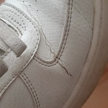 Kısa Sürede Bozulan Skechers Ayakkabı Ve SuperStep'in İlgisizliği