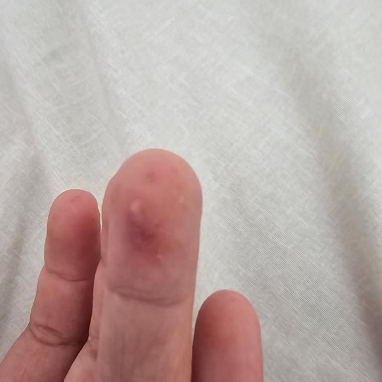 Havuzda Hijyen Ve Personel Davranışlarıyla İlgili Sorunlar