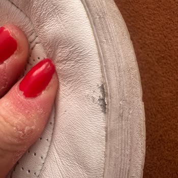 Garanti Kapsamındaki Skechers Ayakkabım İçin İade Ve Değişim Sorunu