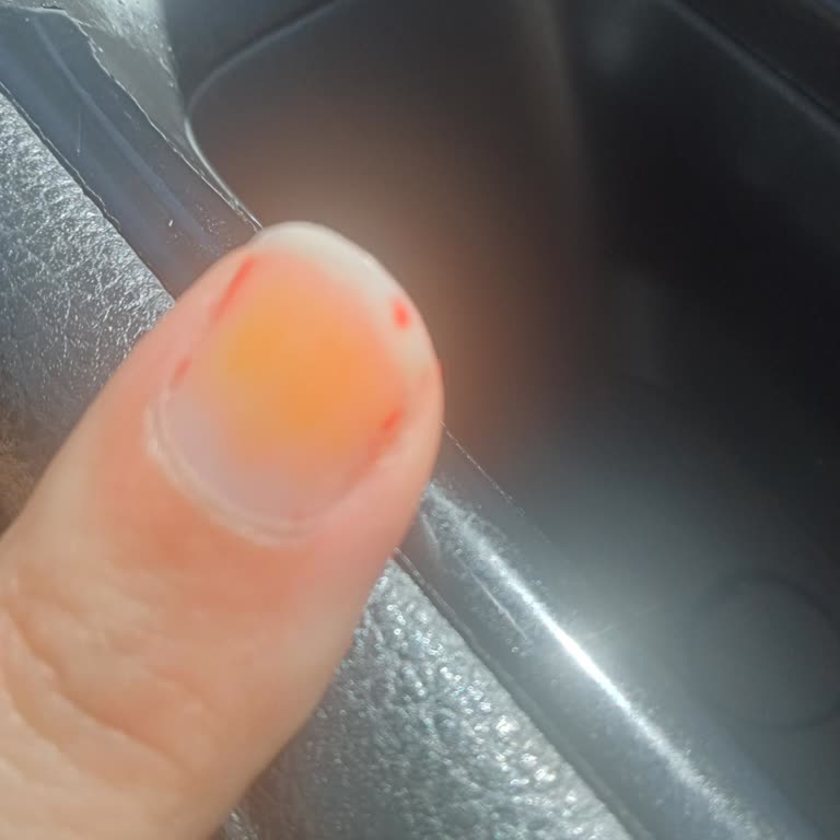 Flormar Oje Sonrası Tırnaklarda Kalıcı Sararma Sorunu