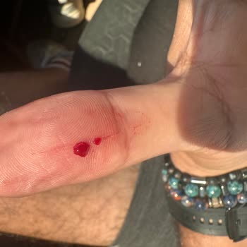 Bomonti Filtresiz Bira Parmağımı Jilet Gibi Kesti