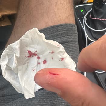 Bomonti Filtresiz Bira Parmağımı Jilet Gibi Kesti