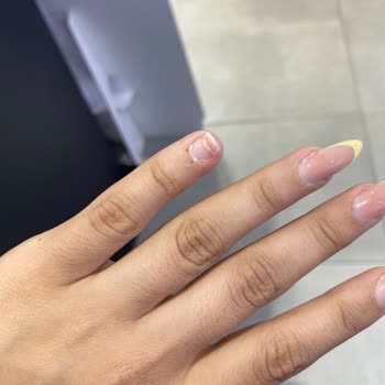 Protez Tırnaklar Bir Haftada Düştü Randevu Ve İlgi Sorunları Yaşadım