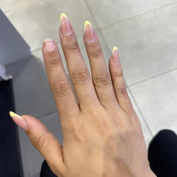 Protez Tırnaklar Bir Haftada Düştü Randevu Ve İlgi Sorunları Yaşadım