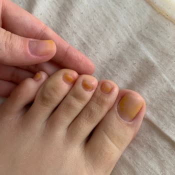 Pastel Nude Oje Tırnaklarımı Sararttı, Çıkmıyor