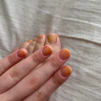 Pastel Nude Oje Tırnaklarımı Sararttı, Çıkmıyor