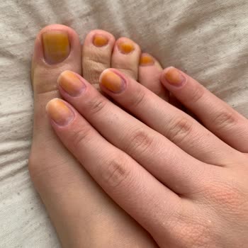 Pastel Nude Oje Tırnaklarımı Sararttı, Çıkmıyor