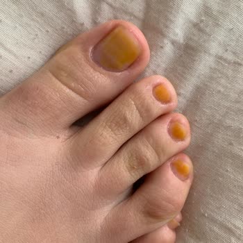 Pastel Nude Oje Tırnaklarımı Sararttı, Çıkmıyor