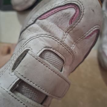 Adidas Beş Günde Deforme Olan Ayakkabı Ve İade Sorunu