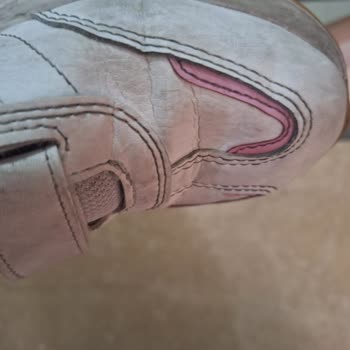 Adidas Beş Günde Deforme Olan Ayakkabı Ve İade Sorunu