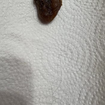 Aldığım Kuru İncir Paketinden Saç Çıktı Hayal Kırıklığı Yaşadım