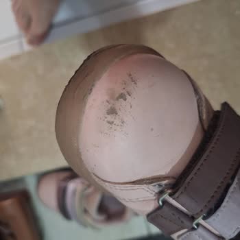 Kısa Sürede Deforme Olan Vicco Çocuk Ayakkabısı İçin İade Talebim