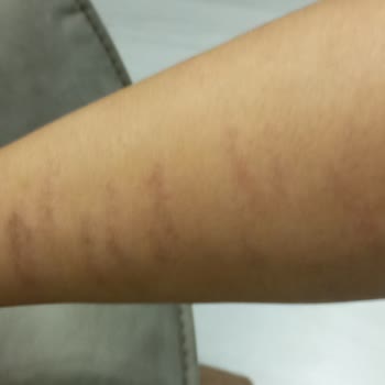 Trim Slim Güzellik Merkezi Lazer Hizmetinden Hiç Memnun Kalmadım