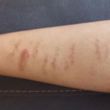 Trim Slim Güzellik Merkezi Lazer Hizmetinden Hiç Memnun Kalmadım