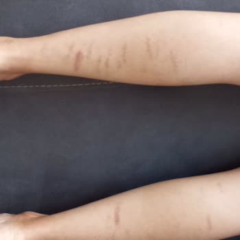 Trim Slim Güzellik Merkezi Lazer Hizmetinden Hiç Memnun Kalmadım