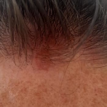 Aldığım Şampuan Saç Derimde Kızarıklık Oluşturdu, Satıcıya Ulaşamıyorum