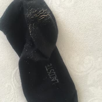 Derimod Ayakkabıda Deri Soyulması Ve Yetersiz Müşteri Hizmeti