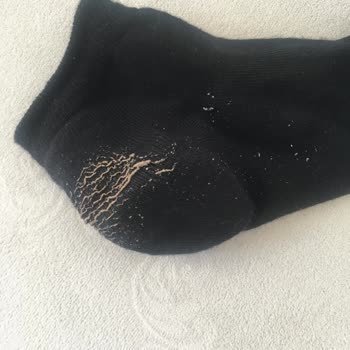 Derimod Ayakkabıda Deri Soyulması Ve Yetersiz Müşteri Hizmeti