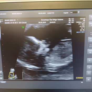 Yanlış Rapor Ve Dikkatsiz Doktor Yüzünden Yaşadığımız Stres