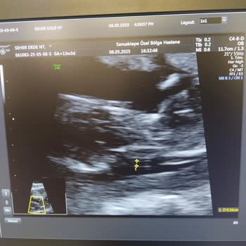 Yanlış Rapor Ve Dikkatsiz Doktor Yüzünden Yaşadığımız Stres