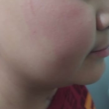 Eyüp Sabri Tuncer Gül Suyu Yüzümde Yanma Yaptı, Test Edilmeden Satılmış