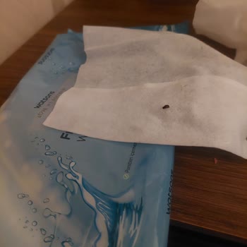 Islak Mendilden Böcek Çıktı, Sağlığım Tehlikeye Girdi!