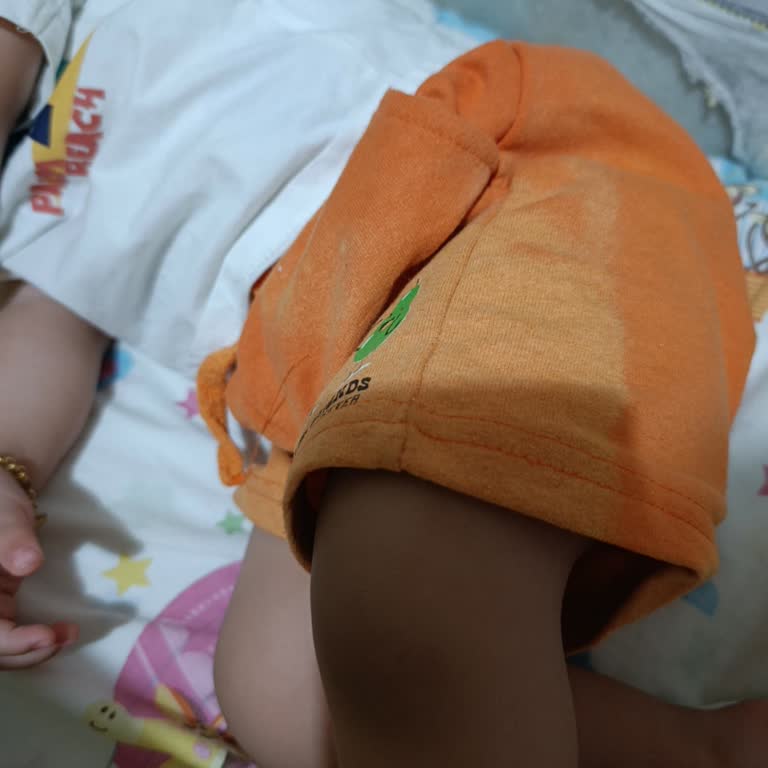 İlk Yıkamada Renk Değişen Bebek Şortu Hayal Kırıklığı