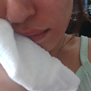 Kozmetik Ürün Cildimde Yanma Ve Ödem Oluşturdu, Sağlığım Tehlikeye Girdi