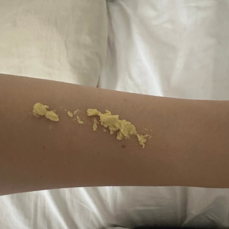 Koruma Bandı Olmadan Gönderilen Bozuk Ürün İçin İade Reddi