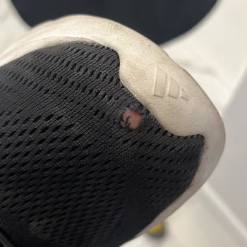 Kullanıcı Hatası Denilerek Ayakkabı Sorunum Çözülmedi