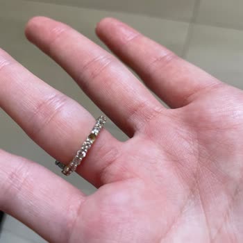 So Chic Yüzükte Sürekli Taş Düşmesi Ve Renk Solması Sorunu