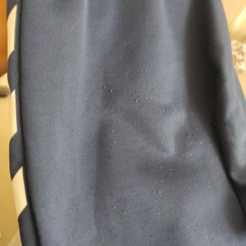 Pahalı Eşofman İlk Giyimde Tüylenip Mağdur Etti, Hummel'dan Çözüm Yok!