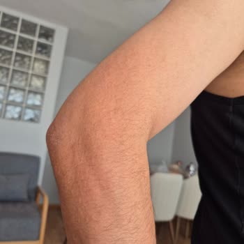 Bioderma Güneş Kremi Ciltte Alerjik Reaksiyona Sebep Oldu, İade Edilmiyor